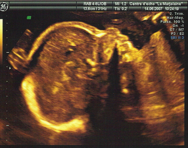 Le profil de mademoiselle, avec sa petite main au-dessus de sa tête